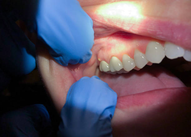 Best Emergency Gum Pain Relief  in Garner, NC